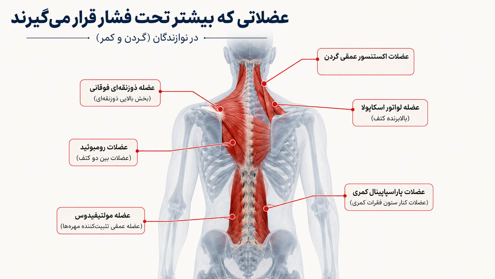 کدام عضلات در نوازندگان بیشتر تحت فشار قرار دارند